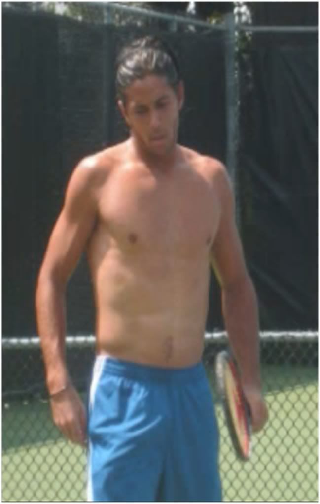 Best Abs in Tennis